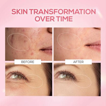 RENEE Pink Therapy PDRN Pink Peptide Serum For Hydrated & Radiant Skin, 30 ml