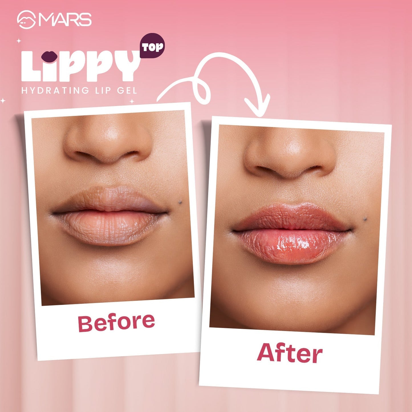 MARS Lippy Top | Hydrating Lip Gel, 10ml